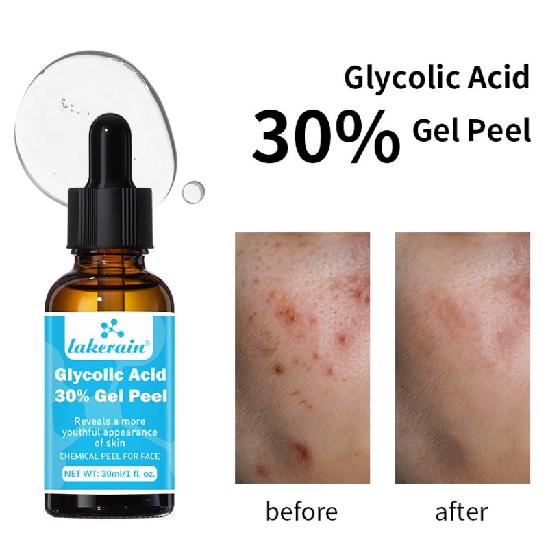 30% Glycolic Acid Peel Gel Pro - Lactic Acid Toner recension och pris